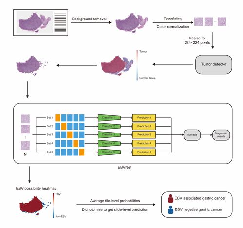 人工智能助力胃癌分子分型 中腫蔡木炎團(tuán)隊(duì)取得研究新進(jìn)展